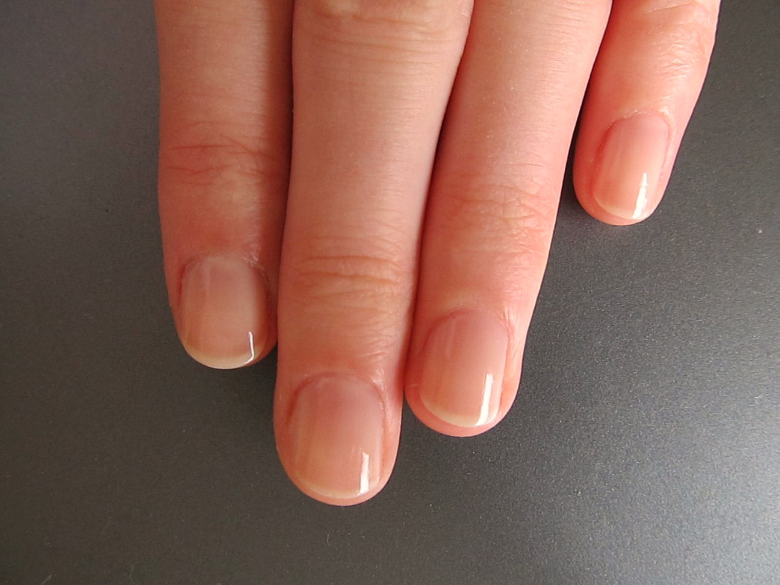 7 Effective Ways To Stop Biting Your Nails Parhlo - 